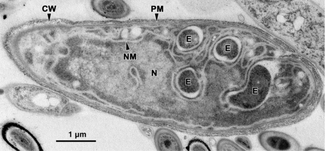 Een bijzondere eencellige, Parakaryon Myojinensis, in de eerste stappen naar eukaryotisch leven?